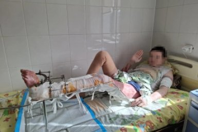 Мальчик находился в состоянии глубокого ожогового шока ДРКБ Бурятии
